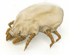 dust mite allergy